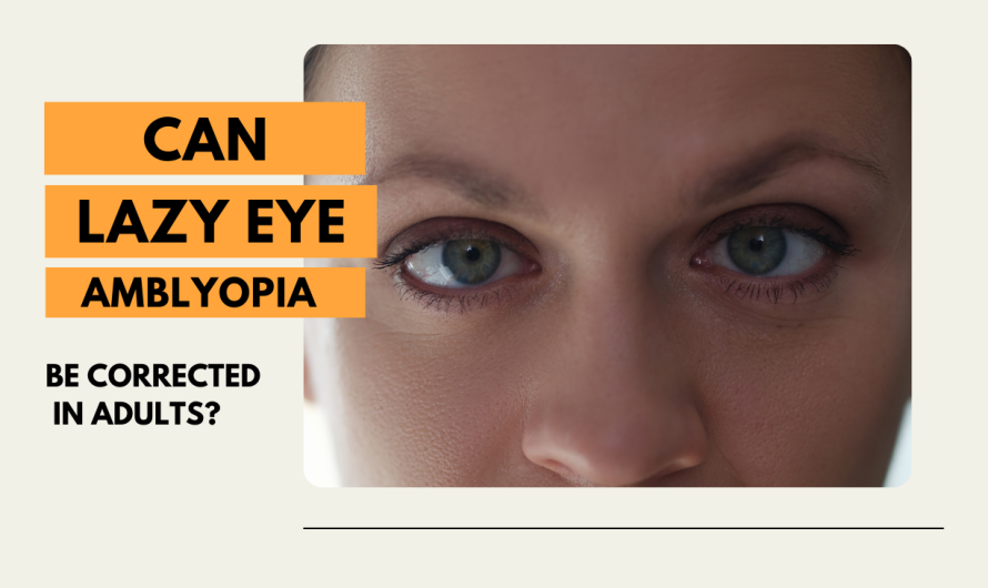 Can Lazy Eye Amblyopia be Corrected in Adults?