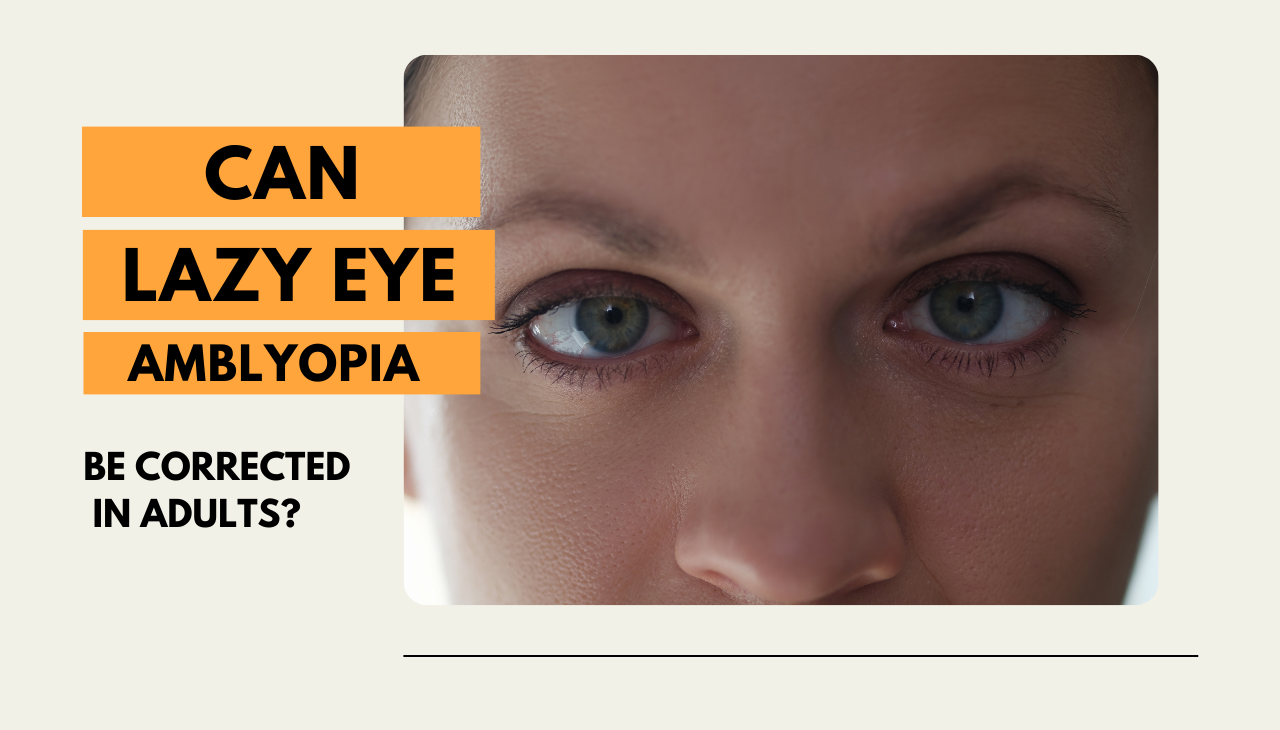 Can lazy eye amblyopia be corrected in adults?