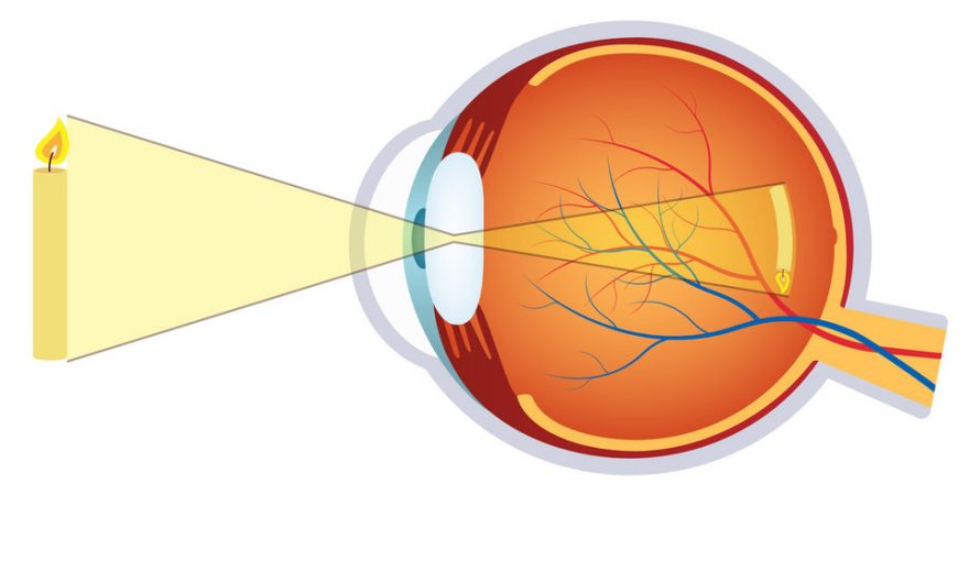 What is long-sightedness or hyperopia?
