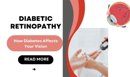 Diabetic Retinopathy Archives - Laxmi Eye Hospital