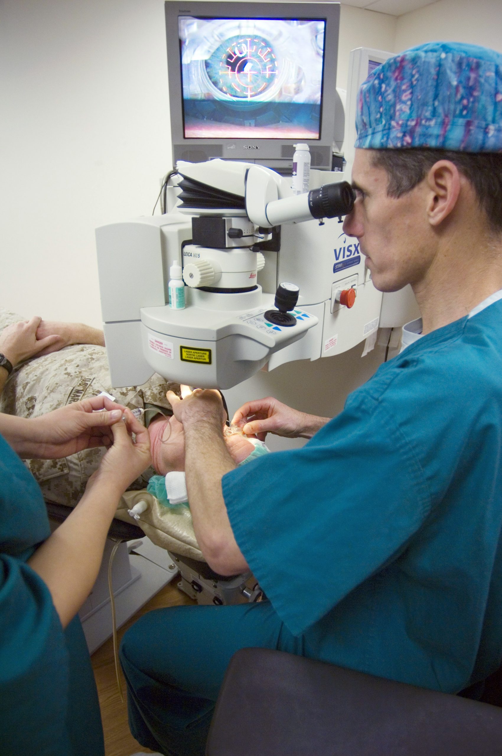 LASIK surgery