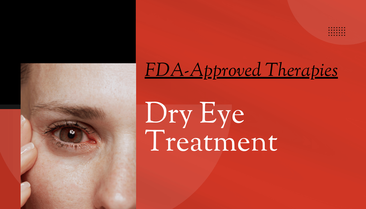 New FDA-Approved Therapies Transform Dry Eye Treatment