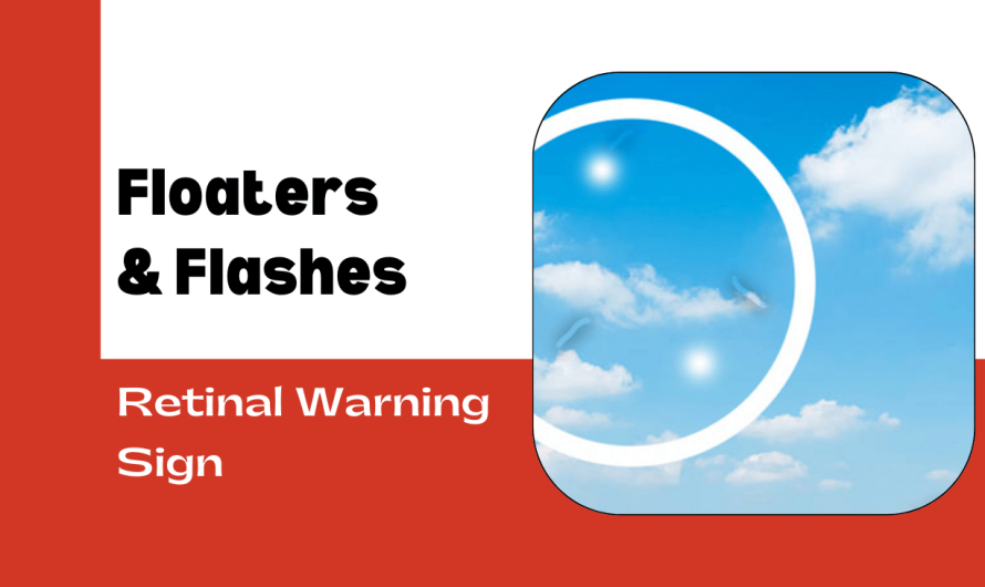 Floaters & Flashes: Is It a Retinal Warning Sign?
