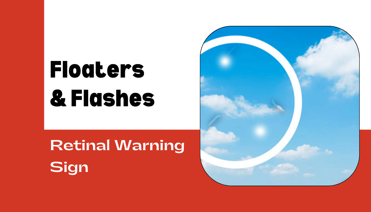Floaters & Flashes: Is It a Retinal Warning Sign?