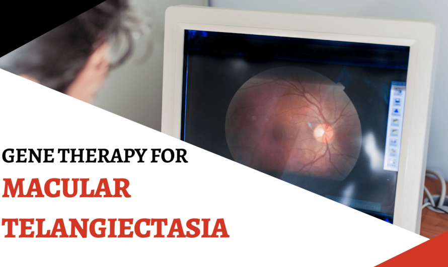 Gene Therapy Offers Hope for Macular Telangiectasia