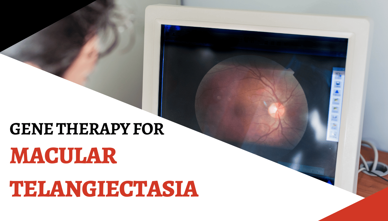 Gene Therapy Offers Hope for Macular Telangiectasia