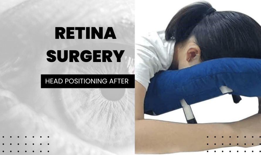 Head Positioning After Retina Surgery