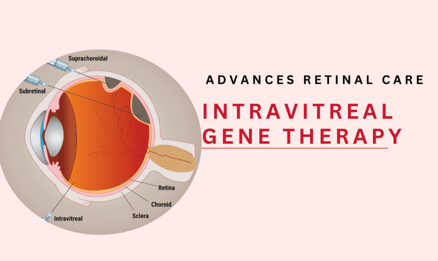 Intravitreal Gene Therapy Advances Retinal Care
