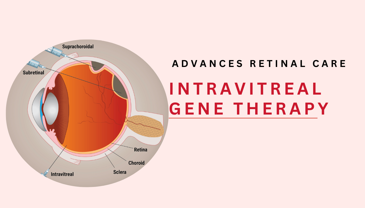Intravitreal Gene Therapy Advances Retinal Care