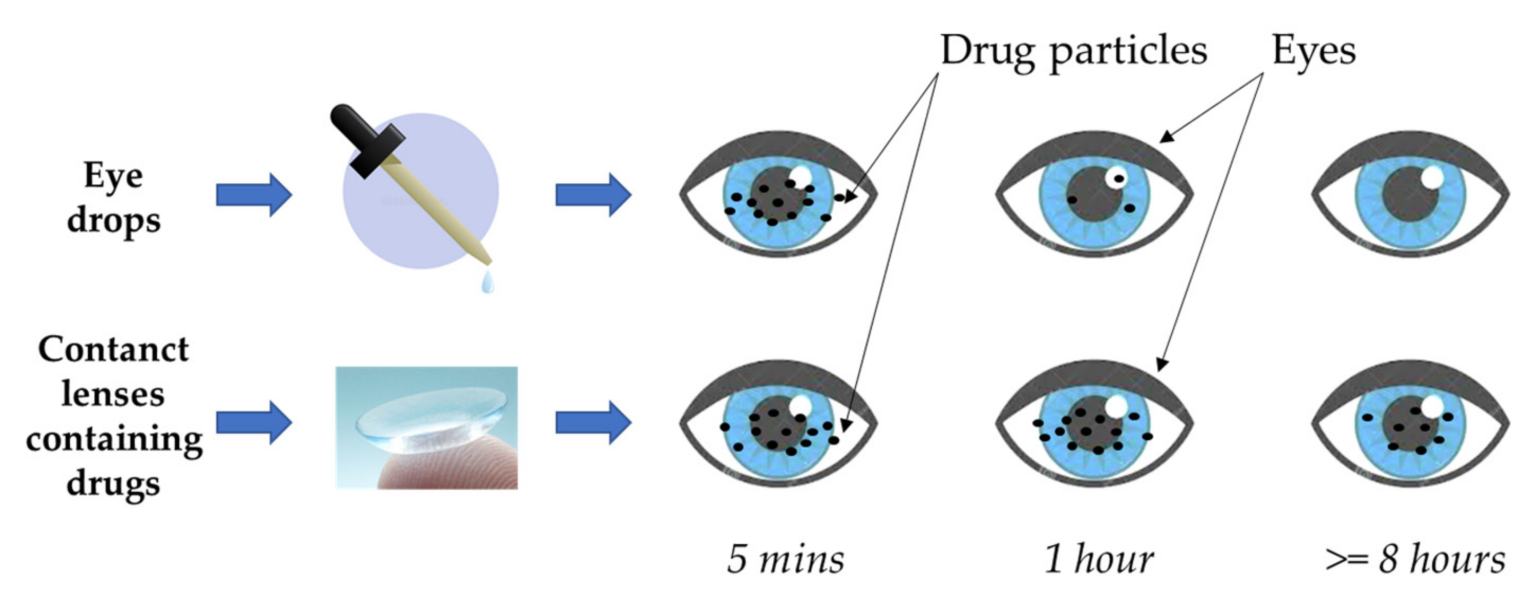 Eye Drops and Contact Lenses: Can You Combine Them? - Laxmi Eye Hospital