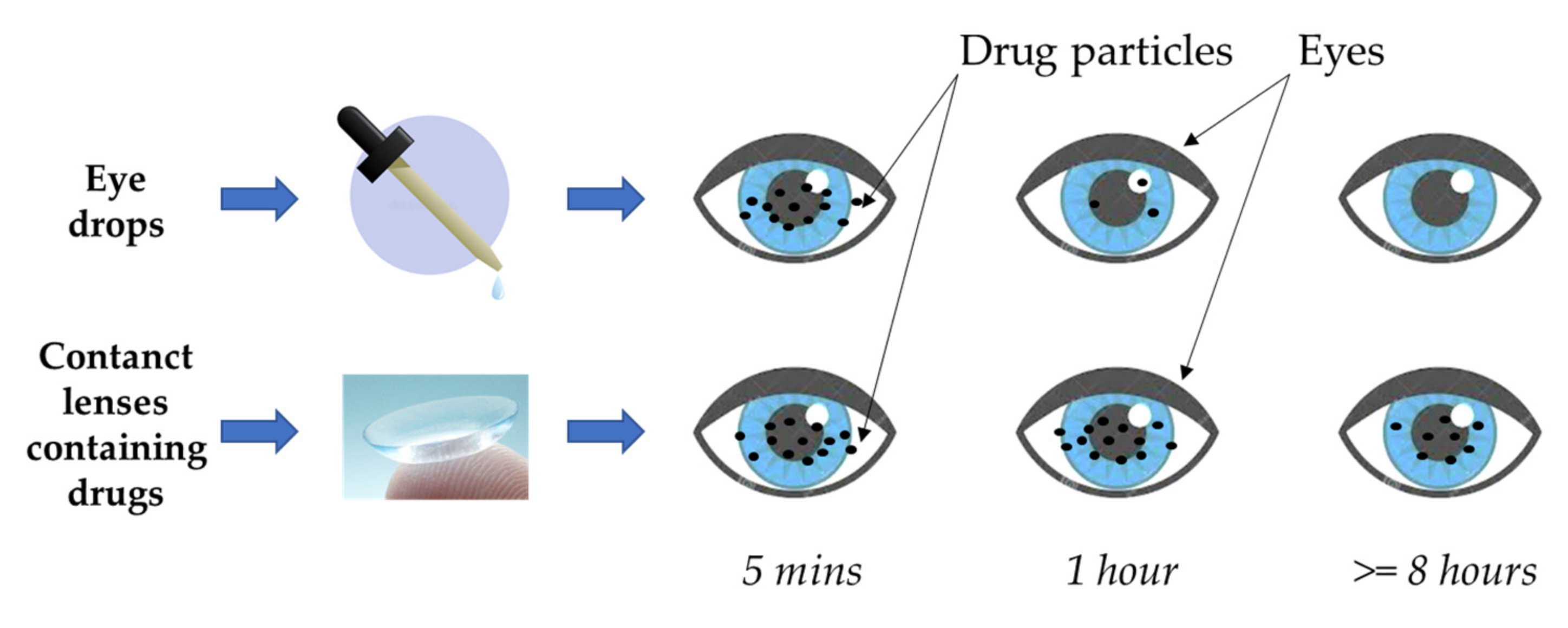 Why Eye Drops and Lenses Can Conflict
