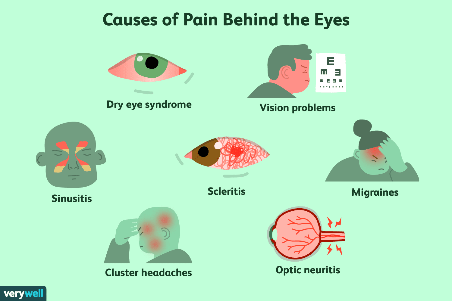 Headache Pain Behind the Eyes