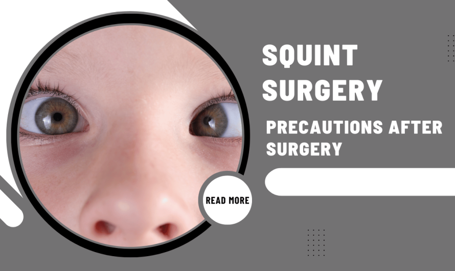 Precautions to Follow After Squint Surgery