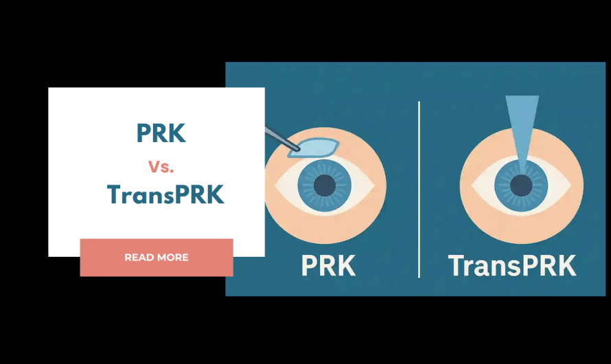 PRK vs TransPRK: Which LASIK Alternative Is Right for You?
