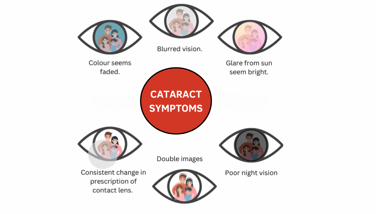 Signs and Symptoms of Cataracts