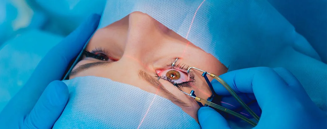 Ideal Candidates for LASIK in Monsoon