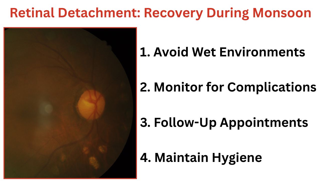 Retinal Detachment: Recovery During Monsoon in Mumbai at Laxmi eye hospital