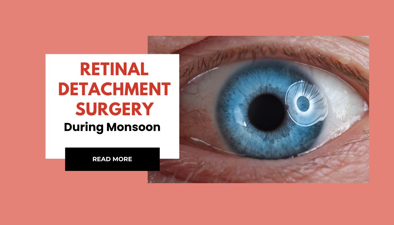 Retinal Detachment Surgery During Monsoon
