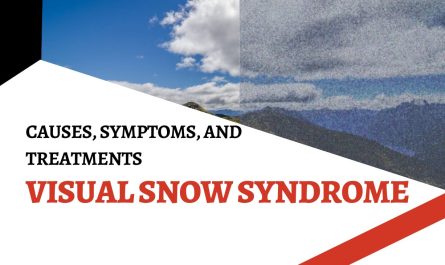 Visual Snow Syndrome: Causes, Symptoms, and Treatments