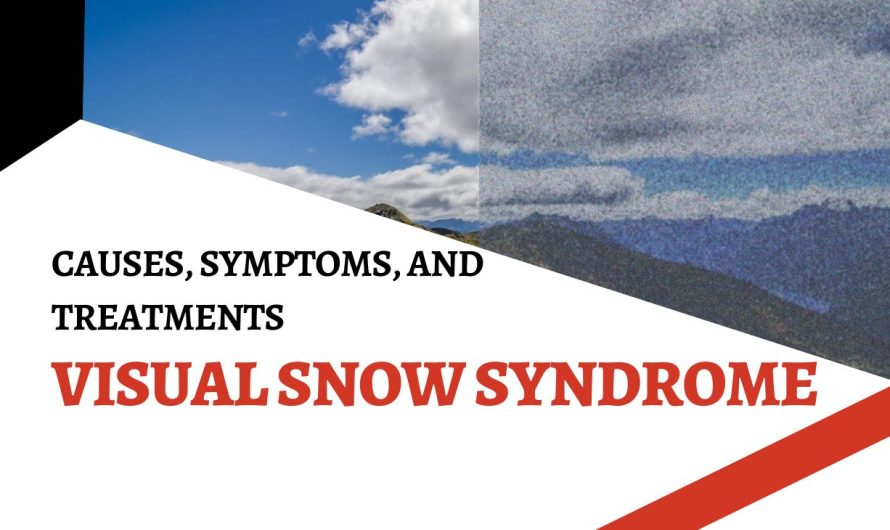 Visual Snow Syndrome: Causes, Symptoms, and Treatments