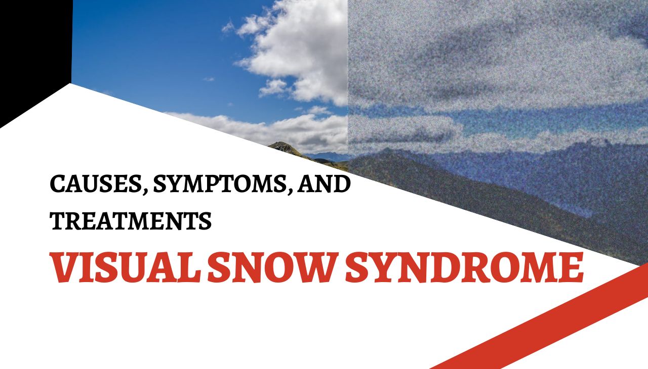 Visual Snow Syndrome: Causes, Symptoms, and Treatments