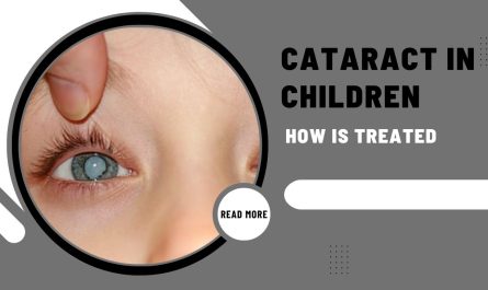 How Cataract In Children Is Treated?