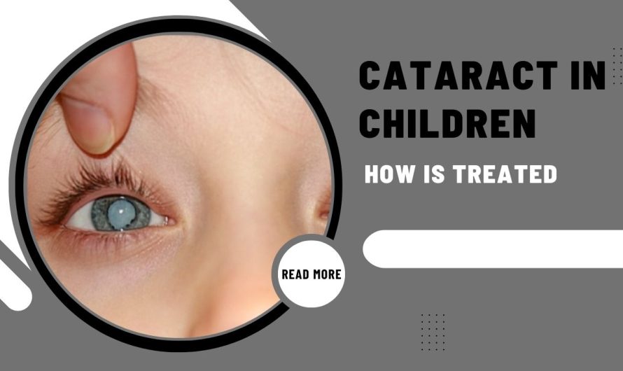 How Cataract In Children Is Treated?