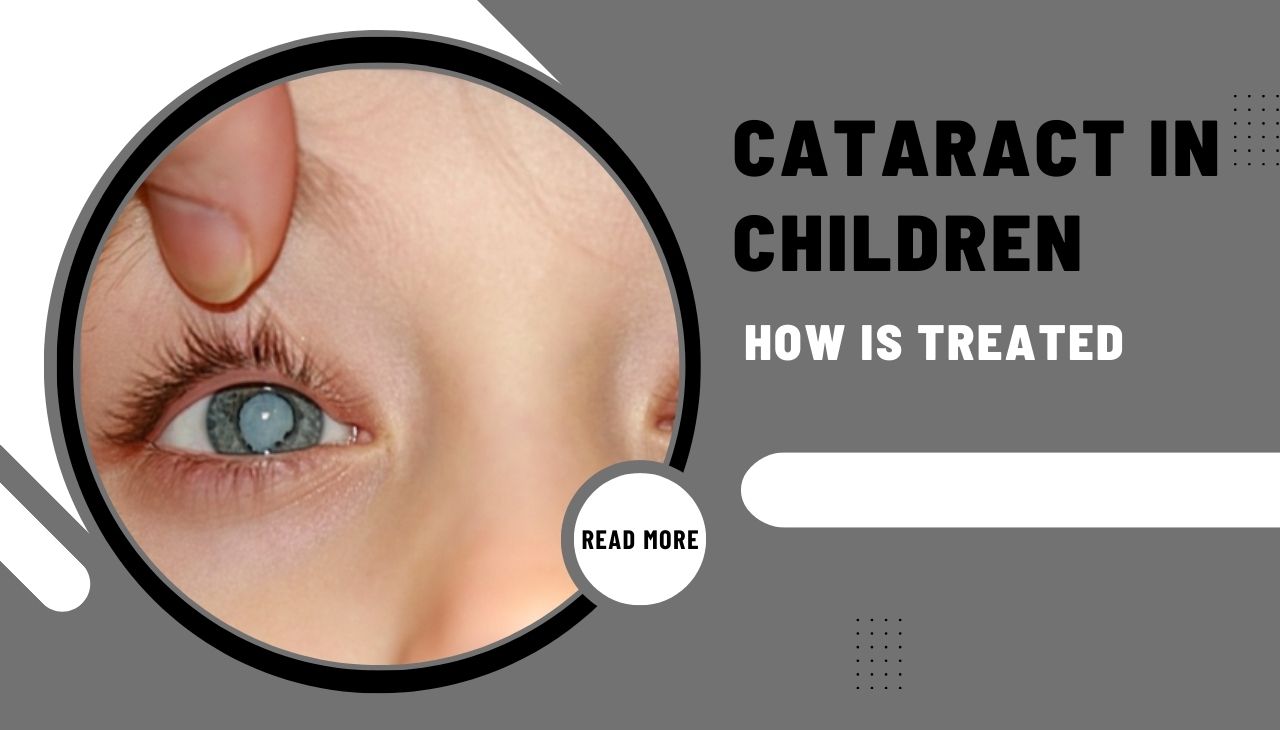 How Cataract In Children Is Treated?