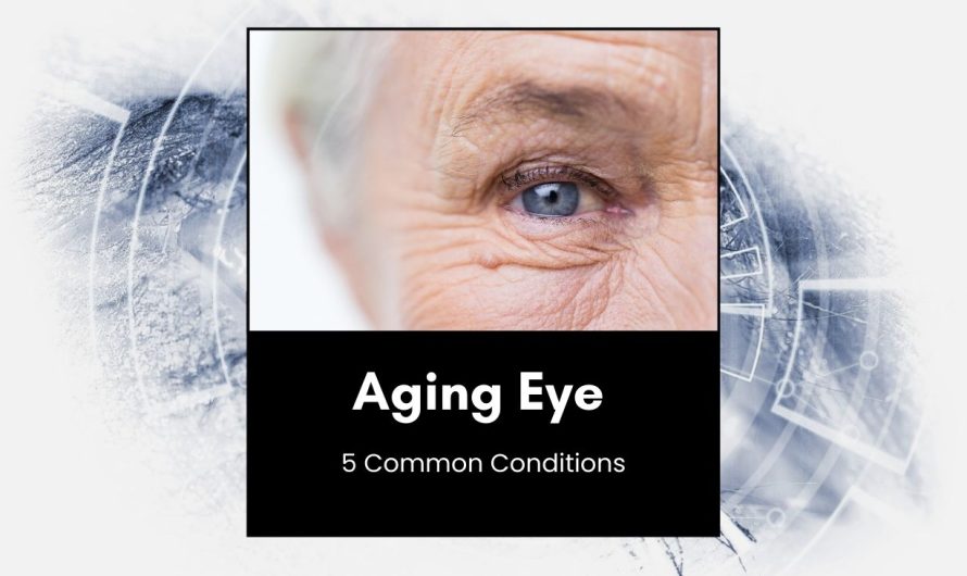 5 Common Conditions of the Aging Eye