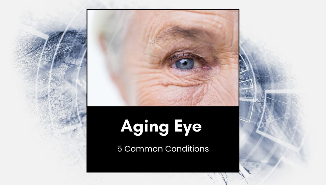 5 Common Conditions of the Aging Eye