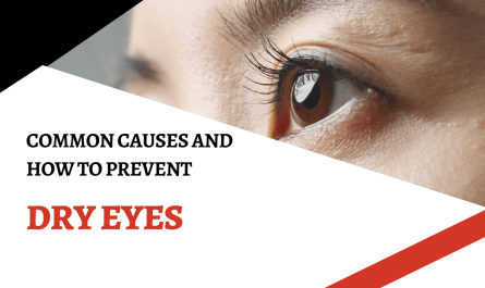 Common Causes of Dry Eyes and How to Prevent Them