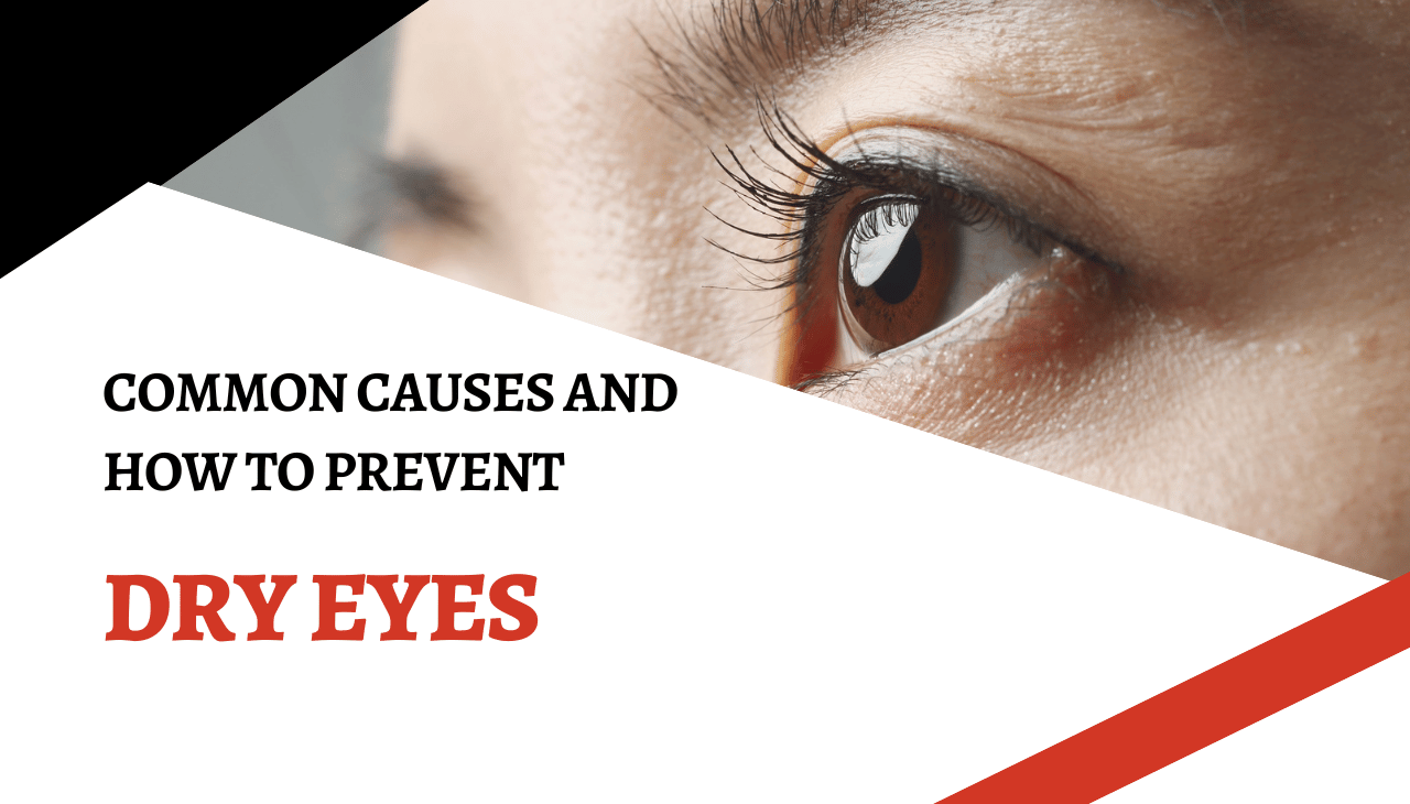 Common Causes of Dry Eyes and How to Prevent Them