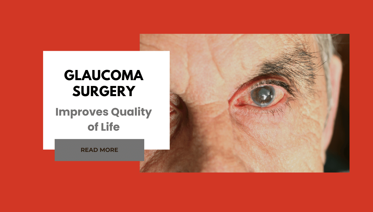 How Glaucoma Surgery Improves Quality of Life