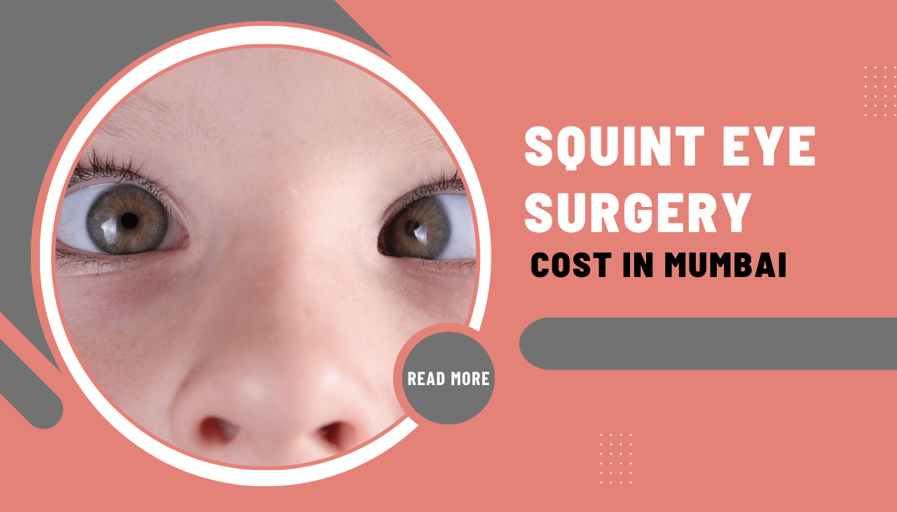 How Much Does Squint Eye Surgery Cost in Mumbai ?