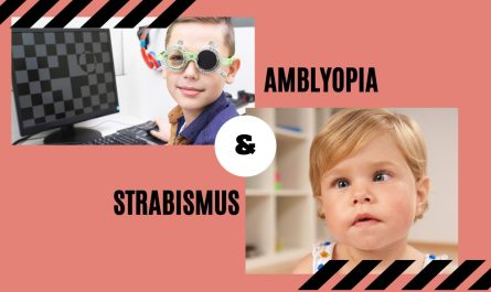 Can Amblyopia Be Caused by Strabismus? Understanding the Connection