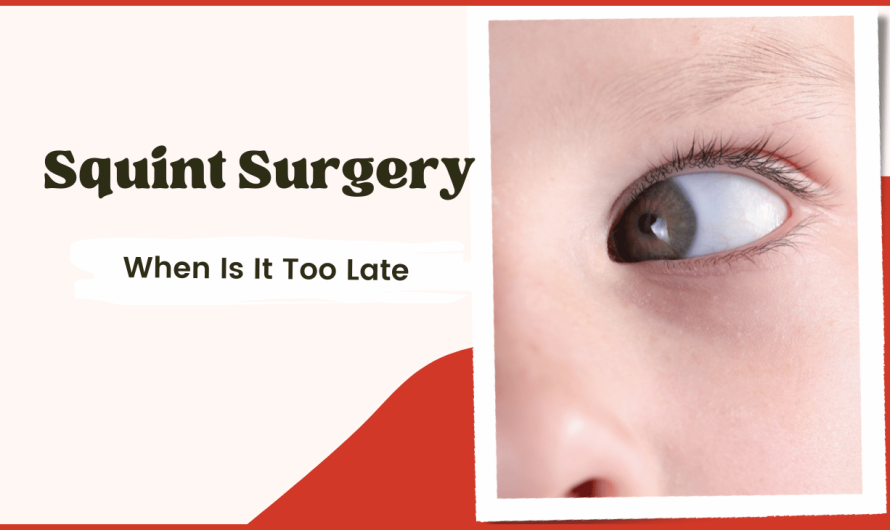 When Is It Too Late for Squint Surgery? Understanding Age Factors
