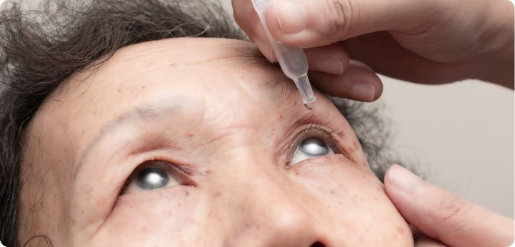 Follow Post-Surgery Instructions Carefully eye care