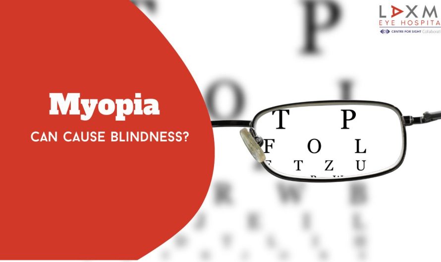 Can Myopia Cause Blindness? The Truth Behind High Myopia Risks