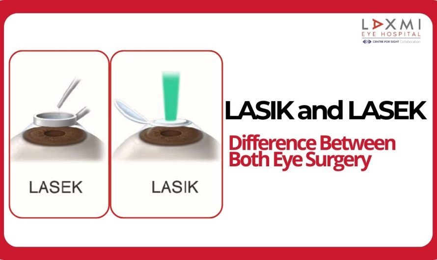 Difference Between LASIK and LASEK Eye Surgery