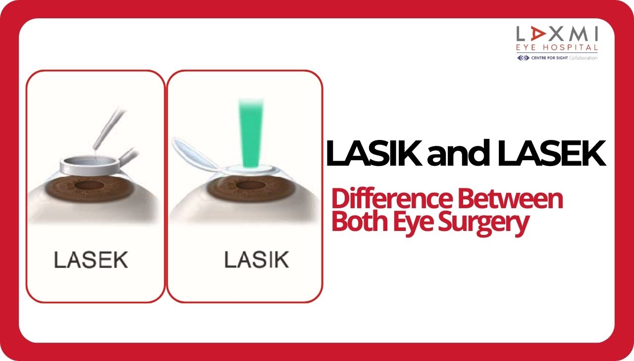 Difference Between LASIK and LASEK Eye Surgery