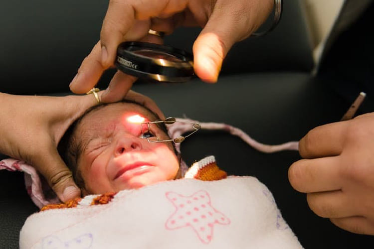 When to Visit an Eye Specialist for newborn
