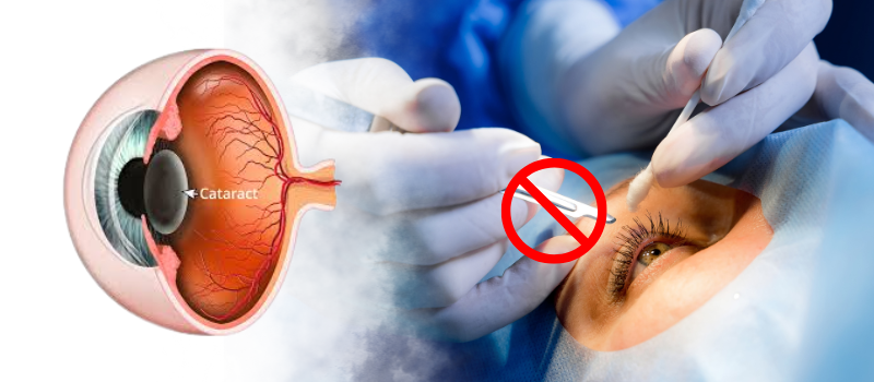 What is Bladeless Cataract Surgery?