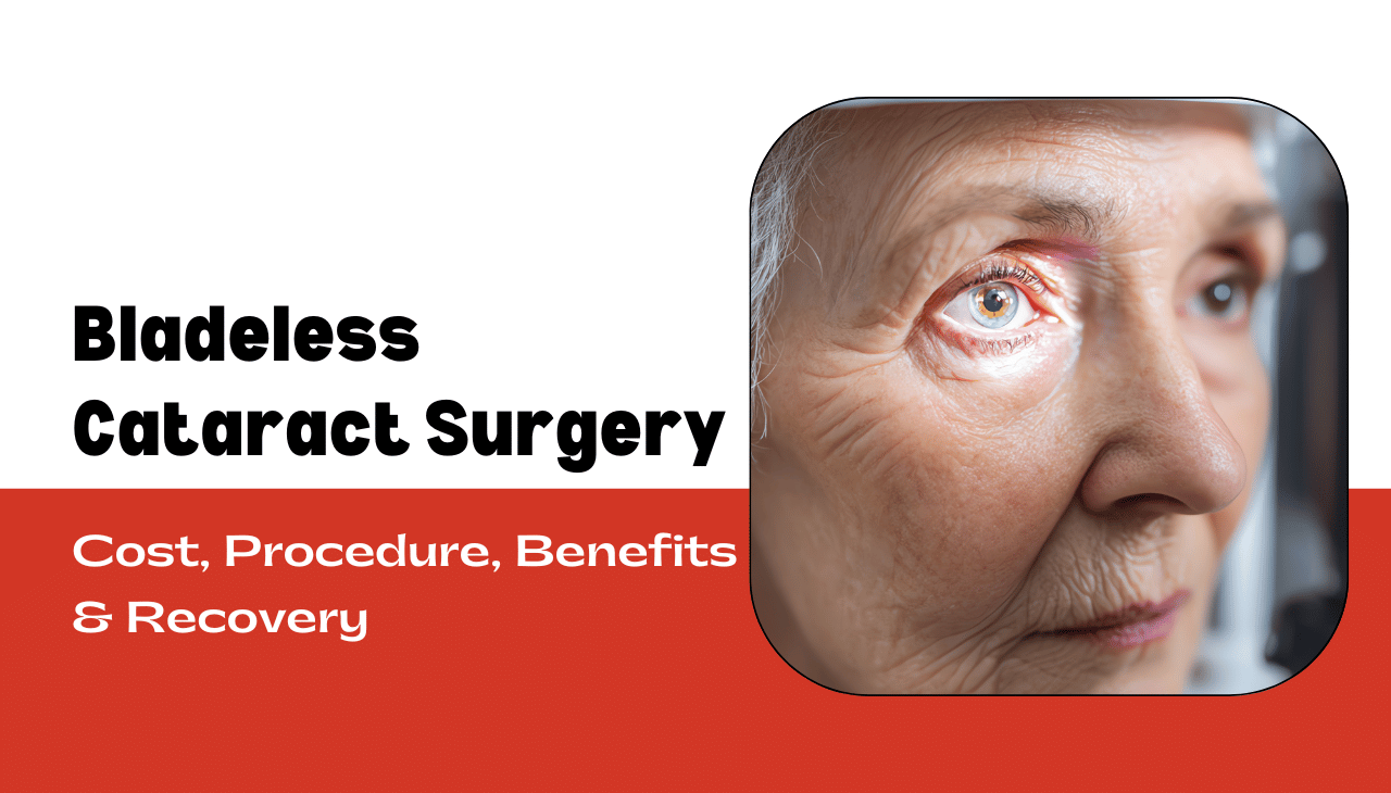 What is Bladeless Cataract Surgery? | Cost, Procedure, Benefits & Recovery