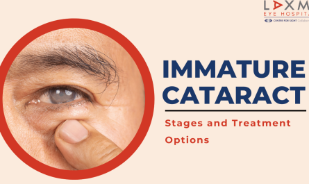 Immature Cataract Stages and Treatment Options You Should Know