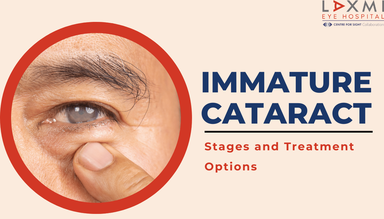 Immature Cataract Stages and Treatment Options You Should Know