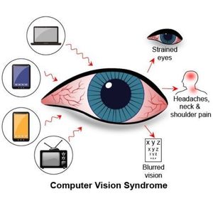 What is Computer Vision Syndrome