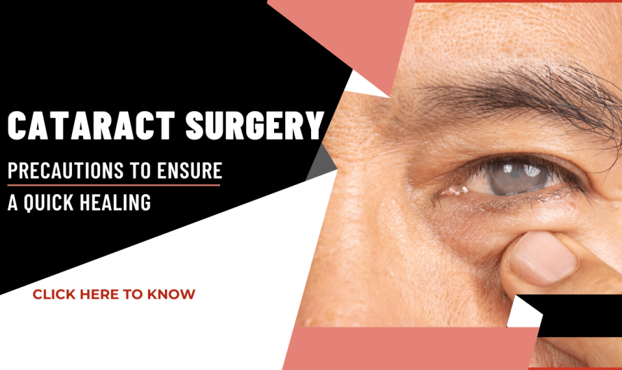 Cataract Surgery Recovery: Important Precautions to Ensure a Quick Healing