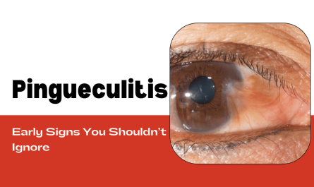 What Is Pingueculitis? Early Signs You Shouldn’t Ignore