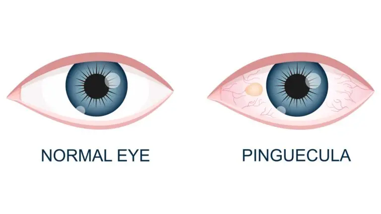 Treatment Options and Best Practices