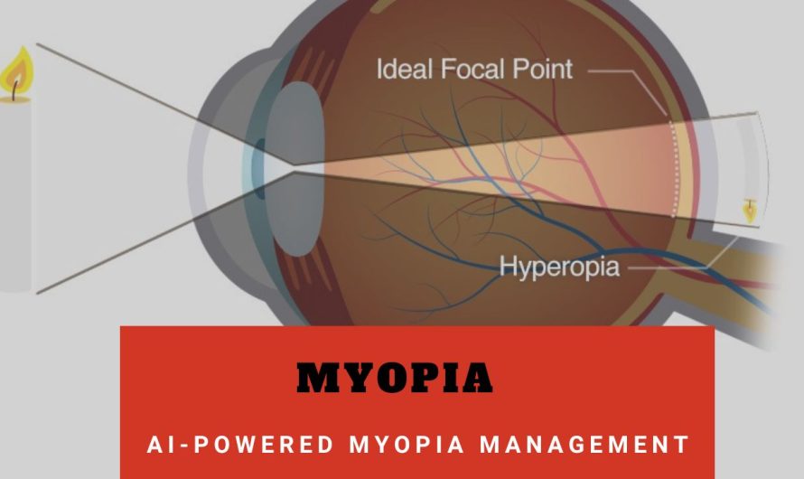 Hypermetropia: Everything You Need to Know About Farsightedness and Its Treatment
